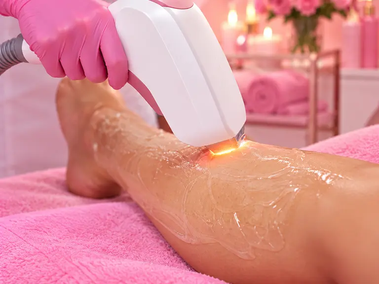 Full Legs Laser treatment showcasing smooth and hair-free legs after sessions